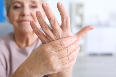Symbolbild für Rheumaorthopädie zeigt rheumatische Hand